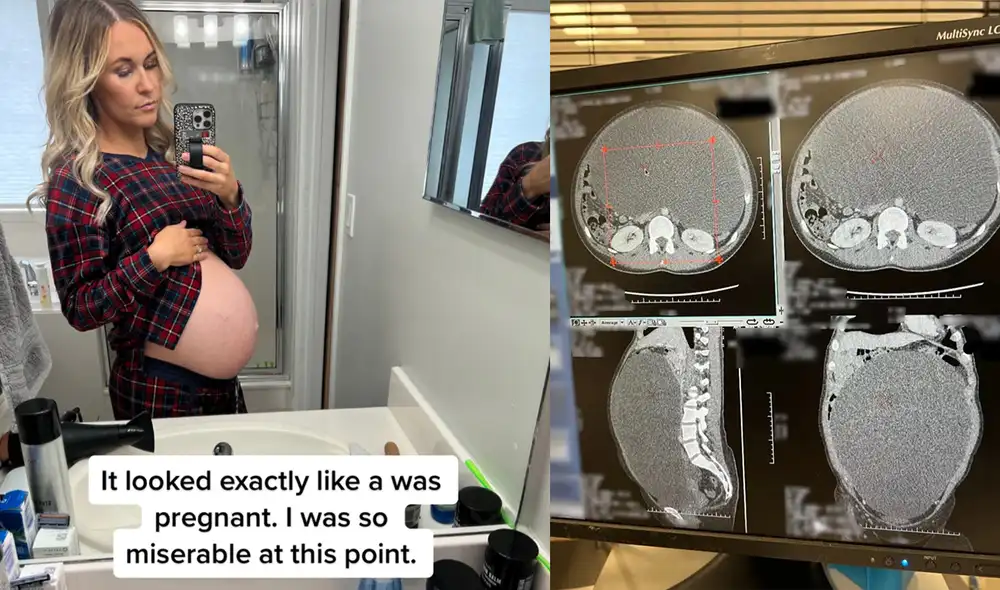 Kenya Smith pasó meses sin saber que el bulto que crecía dentro de ella era un quiste ovárico. Foto: composición LR/ @kenyaksmith/Instagram