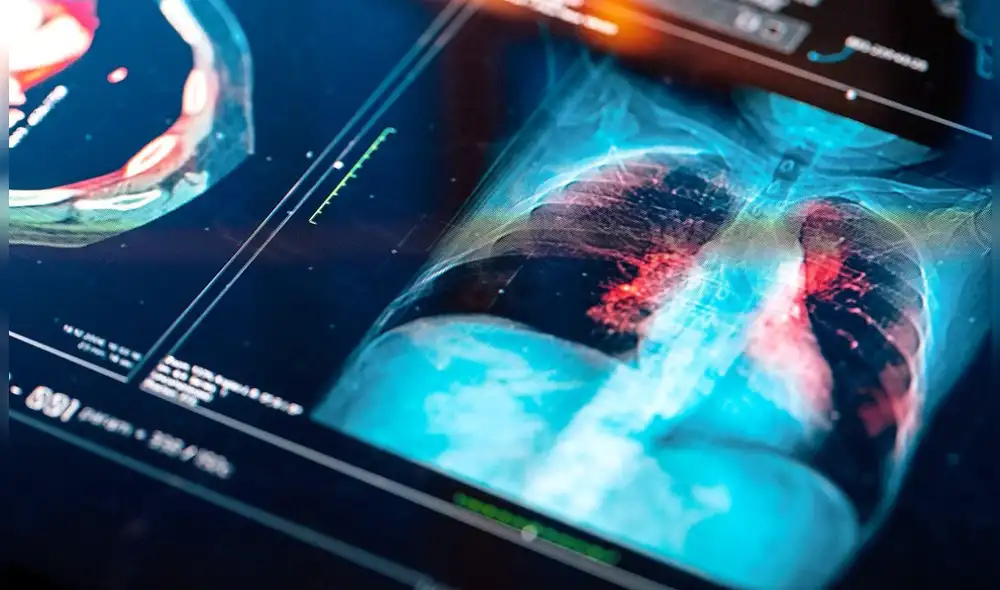 Este método de detección de cáncer no sería invasivo ni caro. Foto: AFP