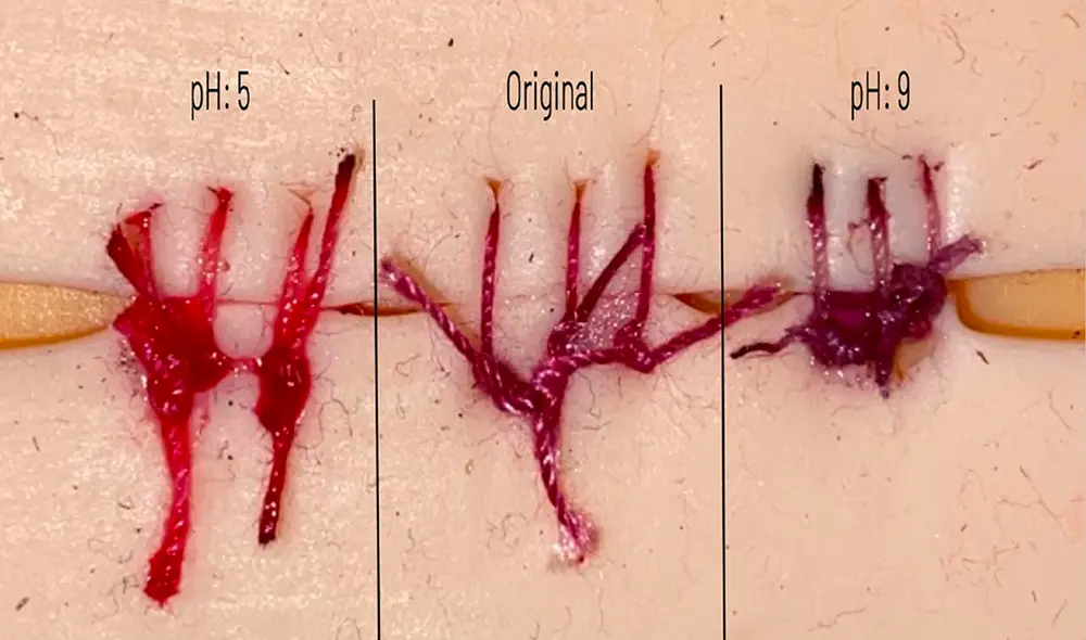 Estos hilos de sutura cambian de color cuando una herida está infectada. Foto: Smithsonian Estos hilos de sutura cambian de color cuando una herida está infectada. Foto: Smithsonian