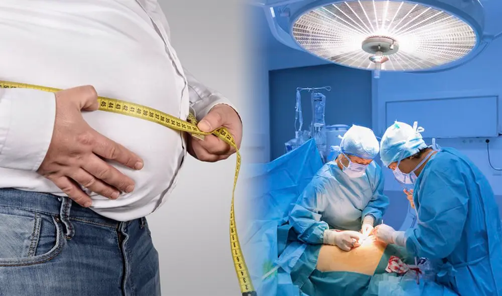 Según los expertos, las personas pueden adelgazar entre 25 y 45 kilos con la cirugía de manga gástrica. Foto: composición LR/ClínicaEndoObesidad/Infosalus