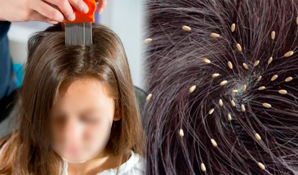 Especialistas refieren que existen ciertos factores que provocan que algunos niños y niñas tengan más piojos que otros. Foto: composición LR/Tododisca/Generali