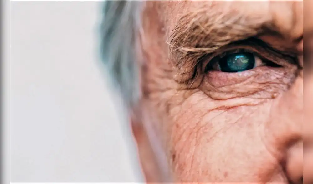 Cataratas, enfermedad visual. Foto: Difusión.