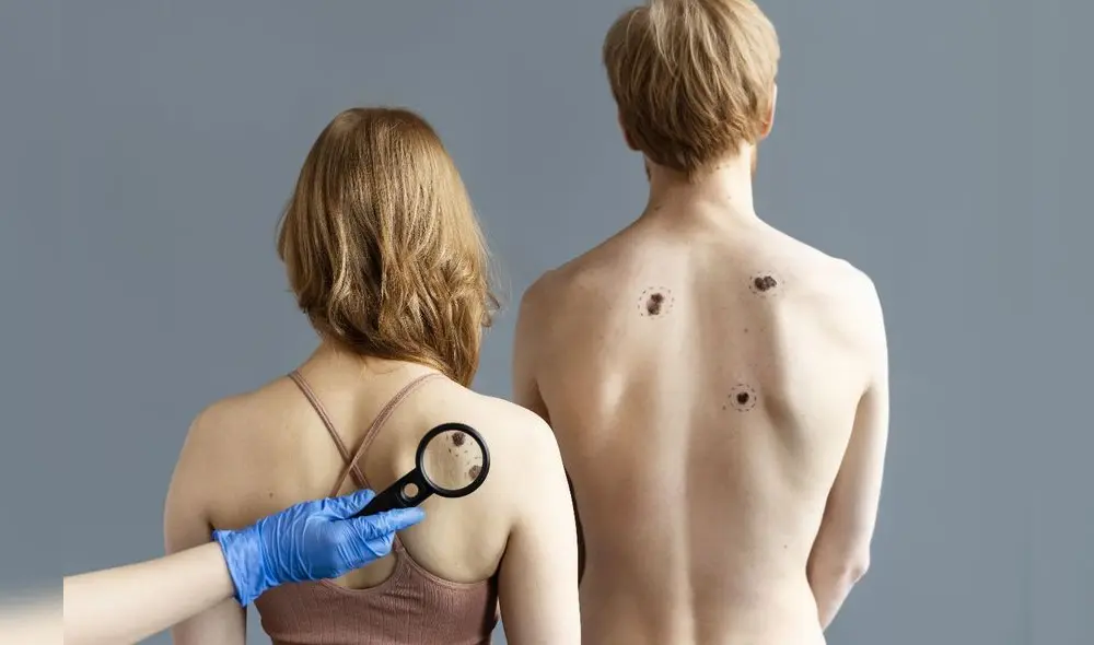 La especialista menciona una serie de recomendaciones para evitar esta enfermedad. Foto: difusión