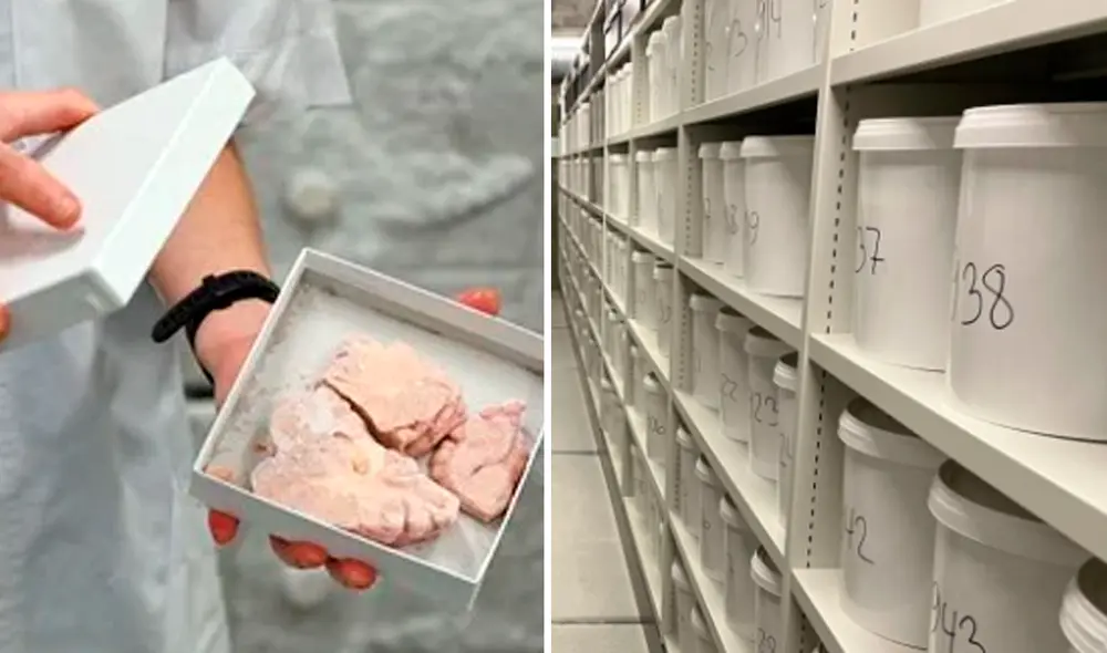La colección de cerebros y toda su documentación están disponibles para cualquier investigador que presente un proyecto relevante. Foto: composición LR/CNN/BBC