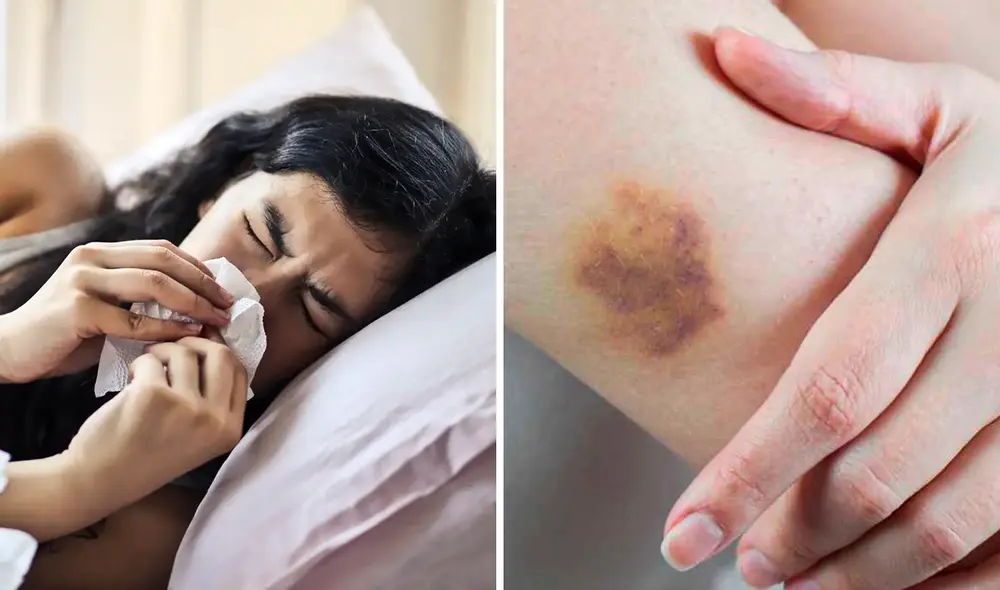 La mujer descubrió que tenía leucemia luego de un mal diagnóstico de amigdalitis. Foto: composición LR/Pexels La mujer descubrió que tenía leucemia luego de un mal diagnóstico de amigdalitis. Foto: composición LR/Pexels