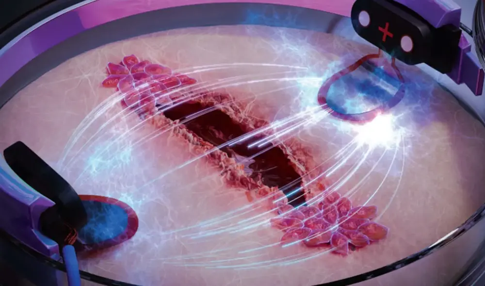 La cicatrización de heridas puede acelerarse utilizando este nuevo método que utiliza corriente eléctrica. Foto: Hassan A. Tahini / Science Brush La cicatrización de heridas puede acelerarse utilizando este nuevo método que utiliza corriente eléctrica. Foto: Hassan A. Tahini / Science Brush