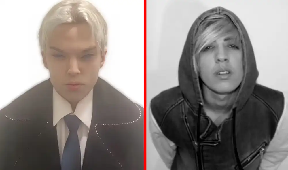 El antes y el después del actor tras someterse al quirófano. Foto: composición LR/TMZ