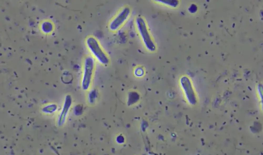 Las bacterias resistentes a los medicamentos son consideradas una "gran preocupación sanitaria a nivel mundial". Foto: microscopes