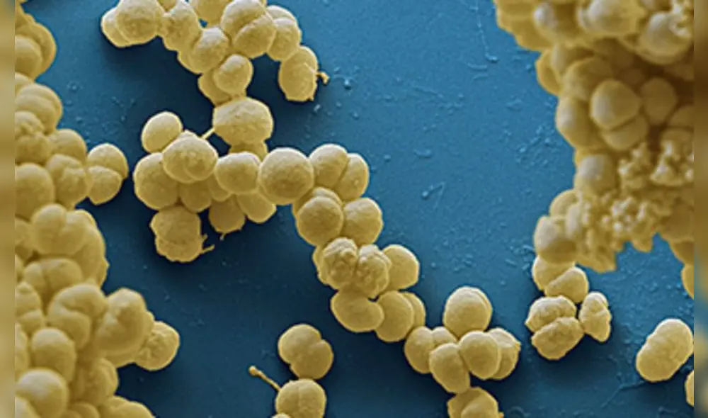 El meningococo es mortal en todos sus casos. Foto: Comité Asesor de Vacunas de la AEP