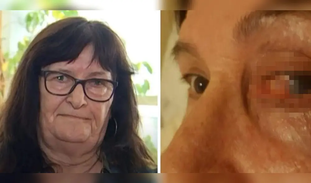 Domi Garrido tuvo una piedra en su ojo durante 54 años. Foto: composición LR/El Heraldo de México/Antena 3