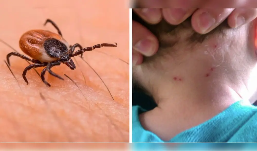 La rickettsiosis viene siendo una infección fatal para México en tiempos calurosos. Foto: composición LR/El Financiero/Reporte Indigo La rickettsiosis viene siendo una infección fatal para México en tiempos calurosos. Foto: composición LR/El Financiero/Reporte Indigo