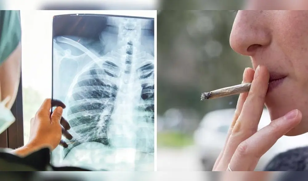 Natasha Loveridge espera advertir sobre su diagnostico de cáncer de pulmón. Foto: composición LR/referencial Oncosalud/Freepik