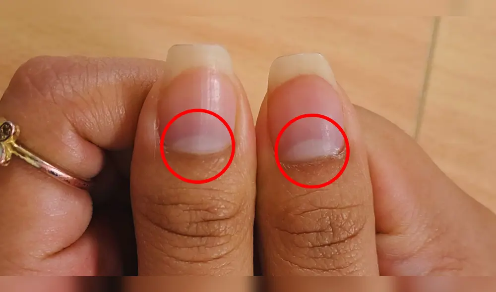 La media luna blanca que aparece en la base de las uñas es conocido como lúnula. Foto: La República La media luna blanca que aparece en la base de las uñas es conocido como lúnula. Foto: La República