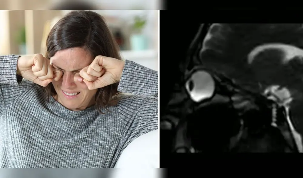 Frotarse los ojos frecuentemente puede generar problemas de salud ocular en el futuro, según advierten los especialistas. Foto: composición LR/Freepik/captura de YouTube Frotarse los ojos frecuentemente puede generar problemas de salud ocular en el futuro, según advierten los especialistas. Foto: composición LR/Freepik/captura de YouTube