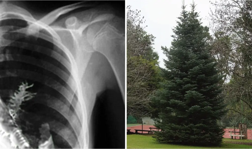 Tan pronto como le extrajeron las ramas, Artyom pudo respirar con normalidad. Foto: composición LR/DailyMail/referencial