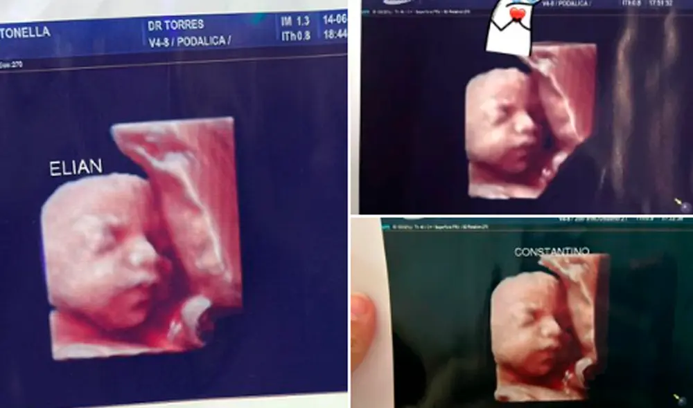 Las afectadas valúan cómo demandar a la clínica que les entregó las mismas ecografías falsas. Foto: RoglanAntonella/Twitter Las afectadas valúan cómo demandar a la clínica que les entregó las mismas ecografías falsas. Foto: RoglanAntonella/Twitter