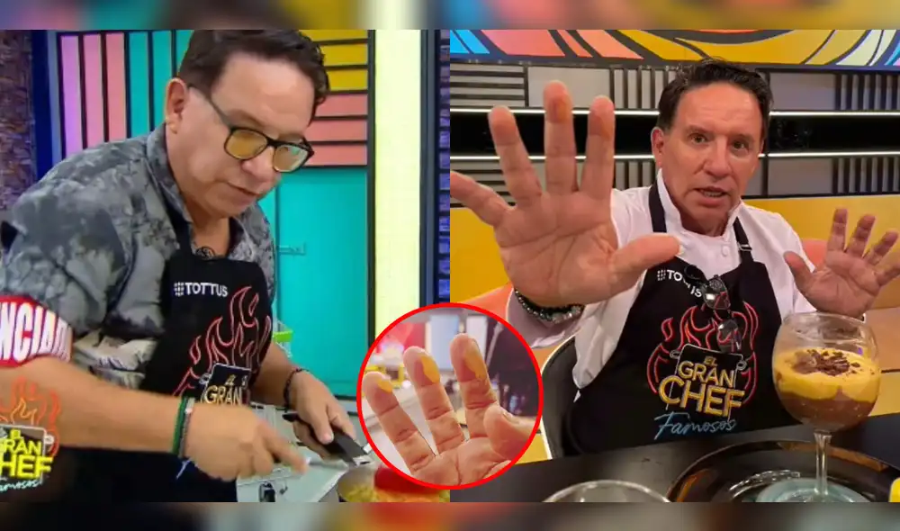 Ricardo Rondón no dudó en mostrar sus dedos luego de varias quemaduras en "El gran chef: famosos". Foto: composición LR/ @RicardoRondon/Twitter