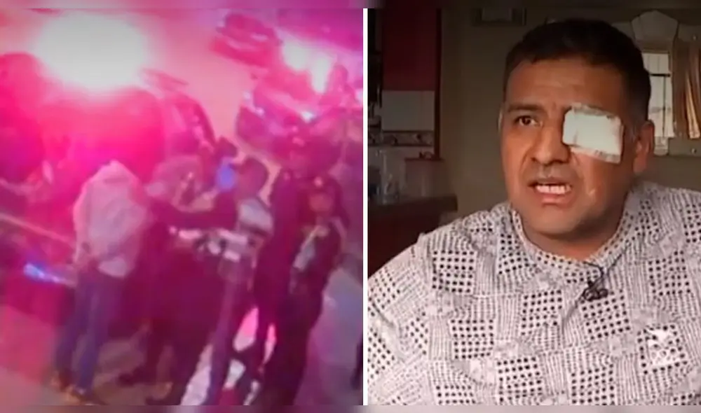 Estanislado y el comandante Castro dan distintas versiones sobre cómo el mecánico perdió la vista del ojo izquierdo. Foto: composición LR / captura de Latina