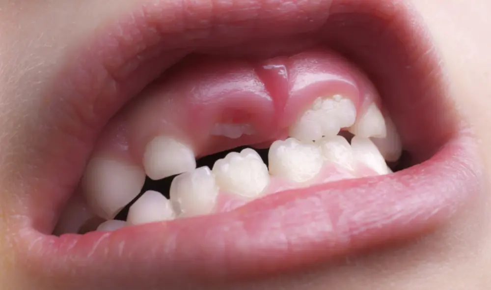 Aprueban los ensayos clínicos en humanos de un fármaco que podría regenerar dientes. Foto: Oral Care Club