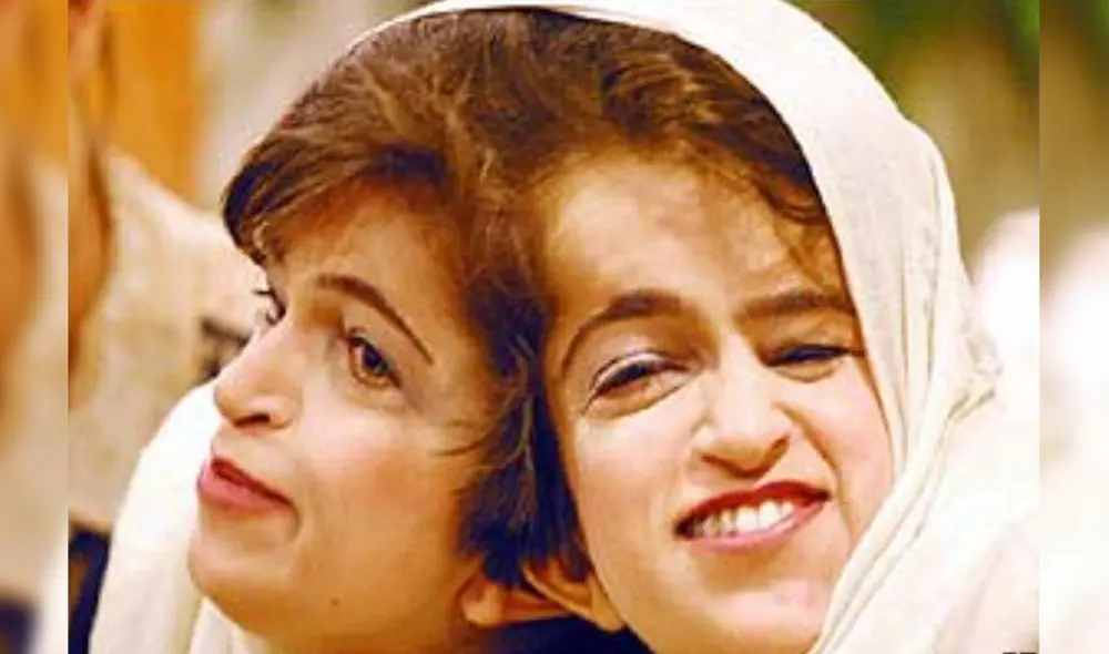 Ladan y Laleh Bijani nacieron en Irán y después de algunos años viajaron hasta Singapur para realizarse la riesgosa operación. Foto: BBC Mundo Ladan y Laleh Bijani nacieron en Irán y después de algunos años viajaron hasta Singapur para realizarse la riesgosa operación. Foto: BBC Mundo