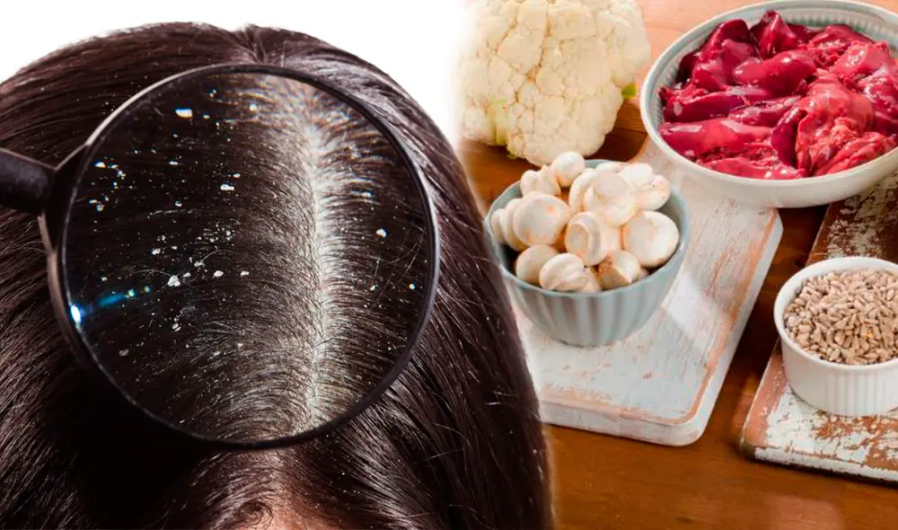 La biotina ayuda a evitar la caída del cabello. Foto: composición/Diario AS/difusión