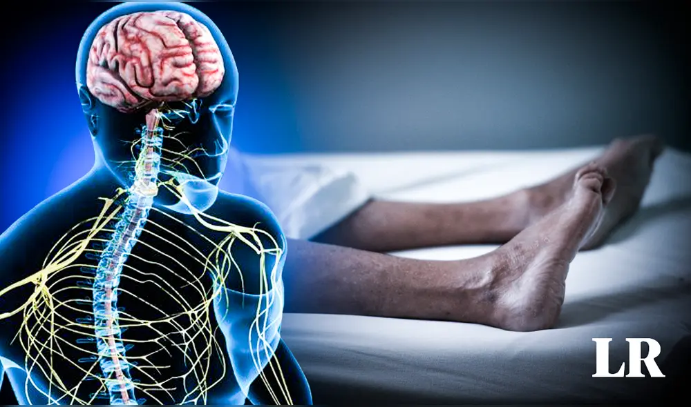 De enero a mayo del 2023 se ha reportado 4 decesos por SGB. Foto: composición LR