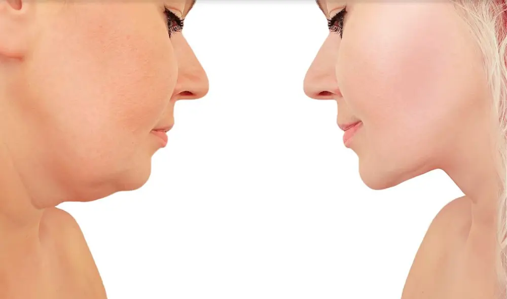 Puedes eliminar la papada consumiendo alimentos que contengan esta poderosa vitamina. Foto: Laskin