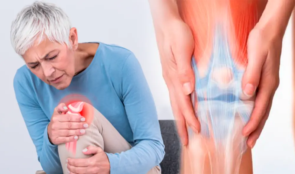 Conoce cuáles son las señales de falta de colágeno en tu organismo. Foto: composición/Clínica Ricardo Palma/difusión