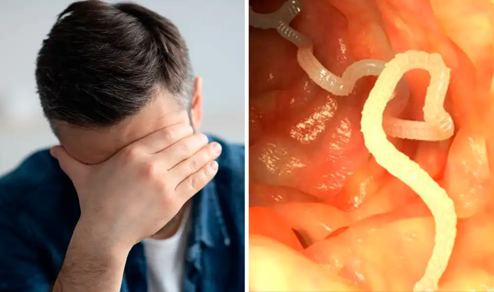 Un hombre acudió al doctor por fuertes dolores en la cabeza y hallaron un gusano de 15 cm alojado en su frente. Foto: composición LR Un hombre acudió al doctor por fuertes dolores en la cabeza y hallaron un gusano de 15 cm alojado en su frente. Foto: composición LR