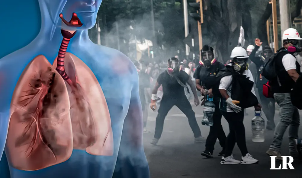 Los gases lacrimógenos pueden tener graves efectos en las vías respiratorias, ojos y piel. Foto: composición LR/difusión/Gabriel García B.