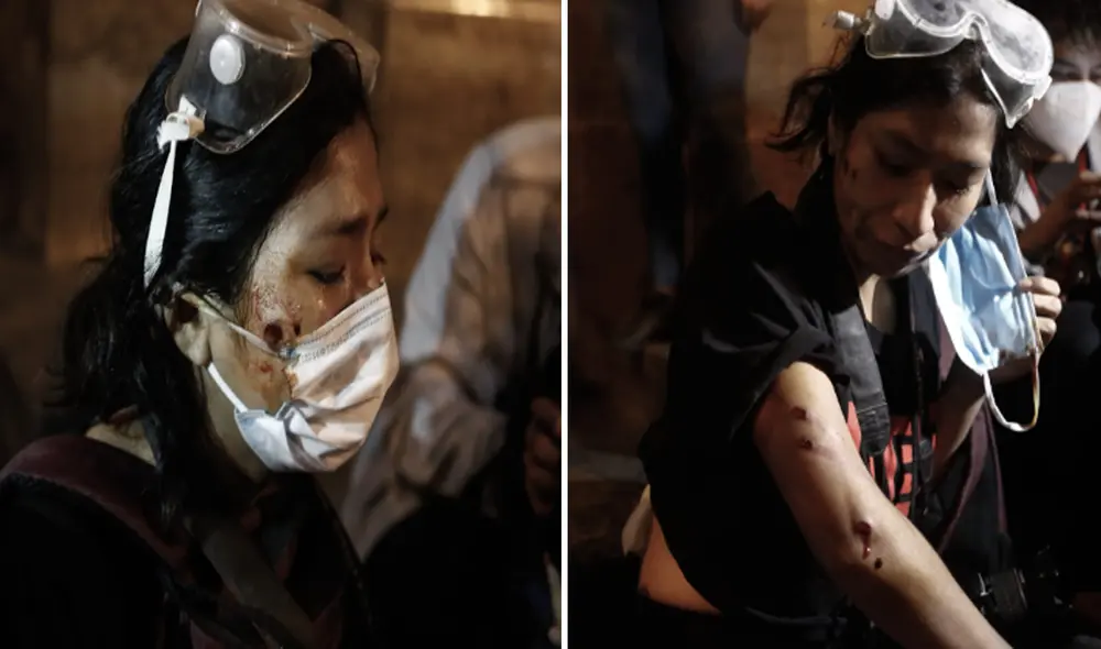 Gabriela Ramos Carbajal fue trasladada al hospital más cercanos por sus colegas para ser atendida. Foto: Marco Cotrina/La República