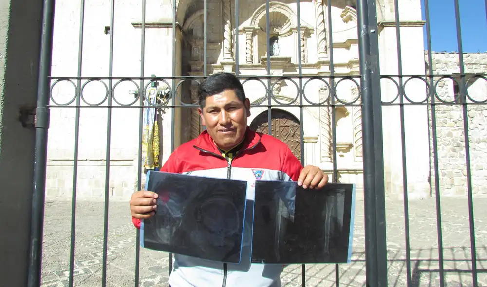 Diego Quispe muestra radiografías que registran disparos. Foto: La República Diego Quispe muestra radiografías que registran disparos. Foto: La República