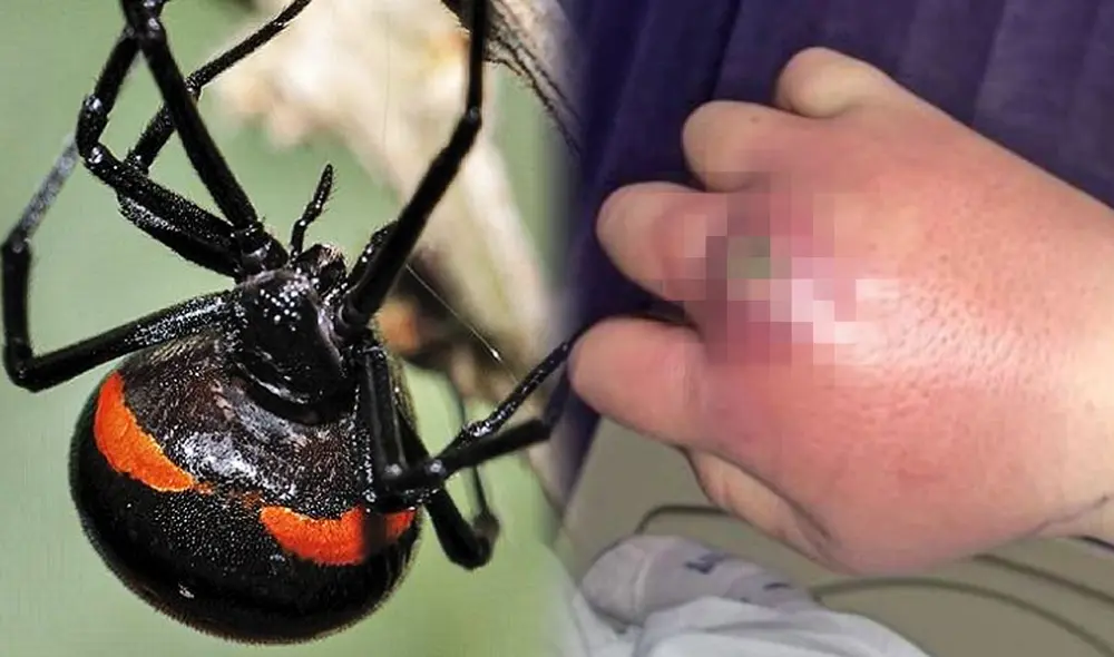El menor de 8 años atrapó a la araña viuda negra para que lo pique. Foto: composición de Jazmin Ceras/LR/Clarín El menor de 8 años atrapó a la araña viuda negra para que lo pique. Foto: composición de Jazmin Ceras/LR/Clarín