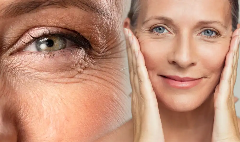 Consumir esta fruta puede ayudar a prevenir el envejecimiento prematuro. Foto: composición/Dermatodo/difusión