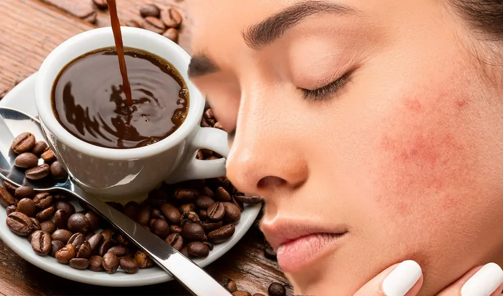 El café puede aumentar la respuesta al estrés y este es capaz de activar un brote de acné. Foto: composición/Minimalist/difusión