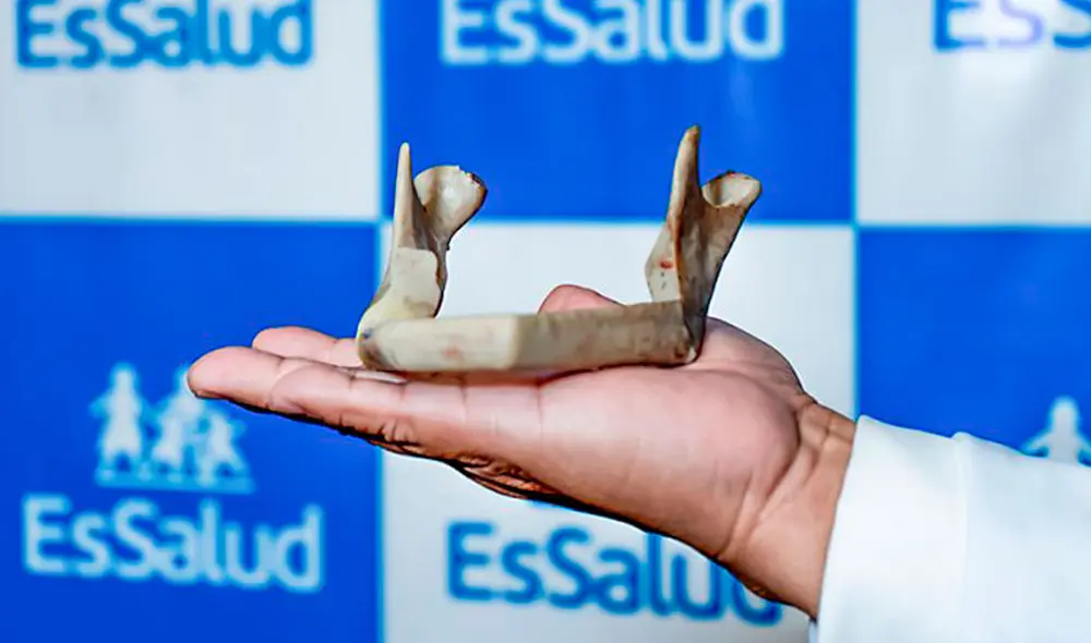 Médicos del Hospital Almenara ayudaron a que paciente venza al cáncer. Foto: EsSalud