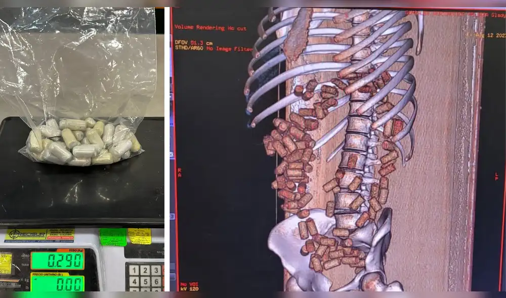 La mujer detenida en flagrancia llevaba cápsulas de droga en el interior y exterior de su cuerpo. Foto: composición LR/Ministerio Público La mujer detenida en flagrancia llevaba cápsulas de droga en el interior y exterior de su cuerpo. Foto: composición LR/Ministerio Público