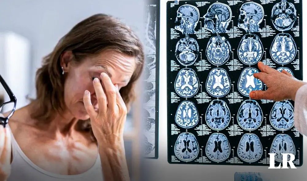 Mujer que creía tener orzuelo descubre que era un tumor cerebral. Foto: Brooklyn Open MRI. Foto: composición de Jazmin Ceras/LR Mujer que creía tener orzuelo descubre que era un tumor cerebral. Foto: Brooklyn Open MRI. Foto: composición de Jazmin Ceras/LR