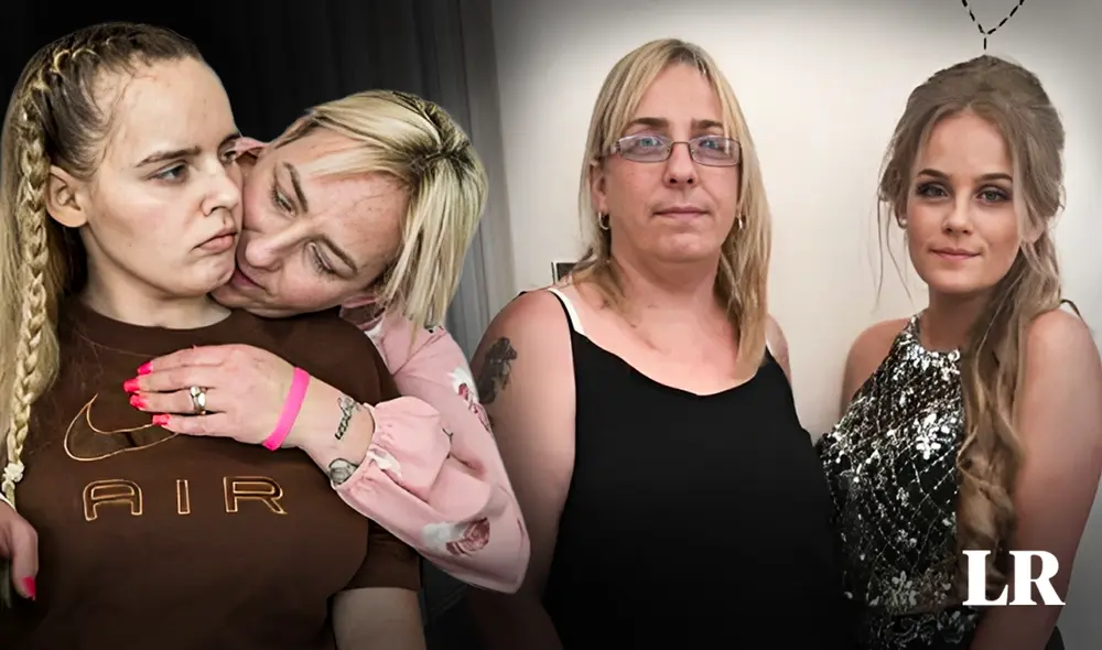 Angel ha logrado dar algunos pasos y mencionar la palabra "mamá" después de 3 años. Foto: composición de Jazmin Ceras/LR/The observer Angel ha logrado dar algunos pasos y mencionar la palabra "mamá" después de 3 años. Foto: composición de Jazmin Ceras/LR/The observer