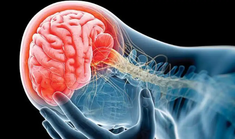 DAÑO. Un ictus o accidente cerebrovascular deja secuelas y el paciente debe acceder a terapia para poder recuperarse. Foto: Difusión