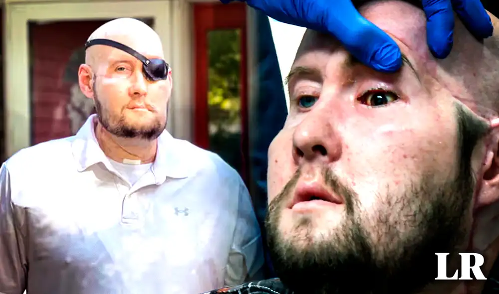 Aaron James es el paciente que recibió la donación. Foto: composición de Gerson Cardoso / La República / NYU Longane Health