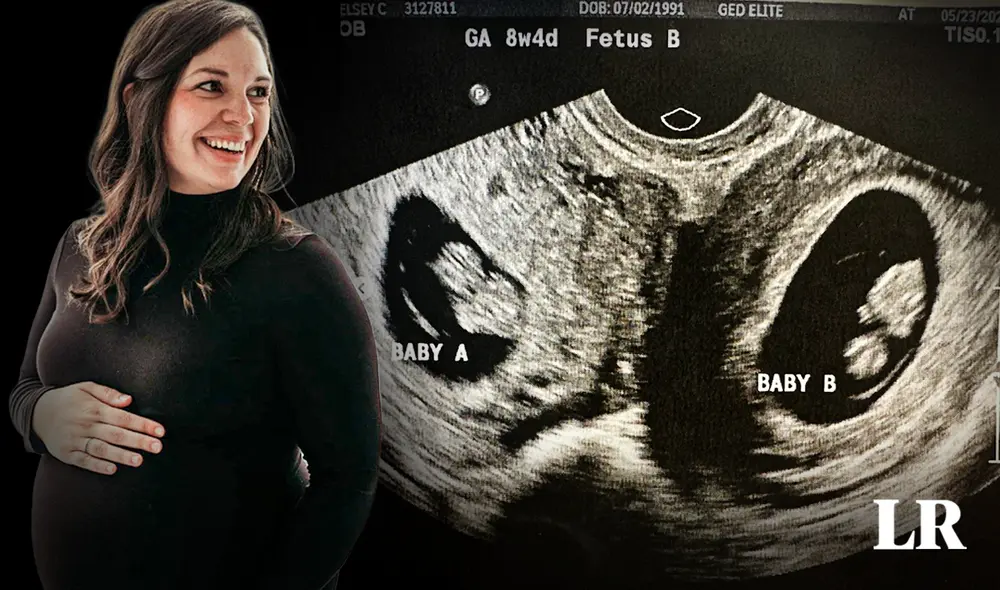 Pese a que tener útero didelfo puede traer riesgos para reproducción, la paciente ya tiene tres hijos. Foto: doubleuhatchlings/Instagram Pese a que tener útero didelfo puede traer riesgos para reproducción, la paciente ya tiene tres hijos. Foto: doubleuhatchlings/Instagram