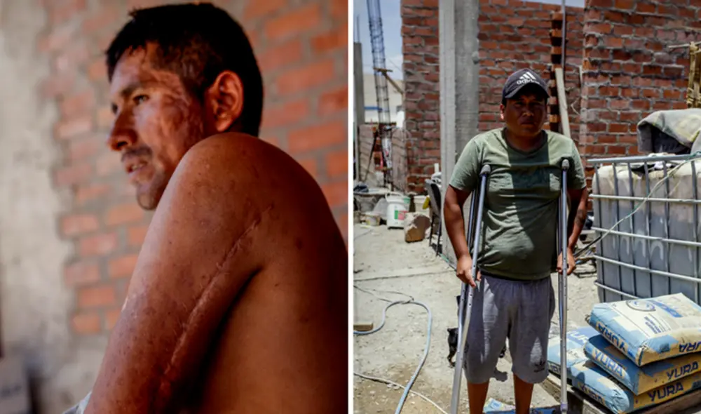 Giovanni Macedo recibió un balazo en el glúteo que le quitó movilidad en las piernas. Bernardino está discapacitado del brazo y a Reynaldo le cayó bala perdida. Foto La República Giovanni Macedo recibió un balazo en el glúteo que le quitó movilidad en las piernas. Bernardino está discapacitado del brazo y a Reynaldo le cayó bala perdida. Foto La República