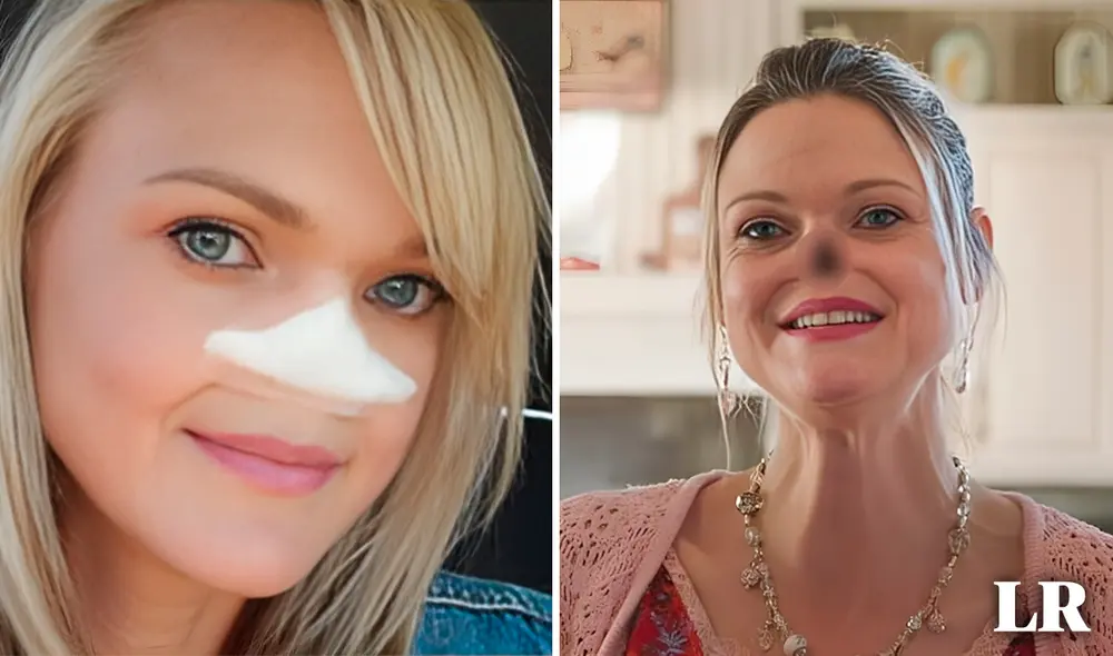 Tina Earls fue diagnosticada con cáncer nasal en el año 2014. Foto: composición LR/ABC