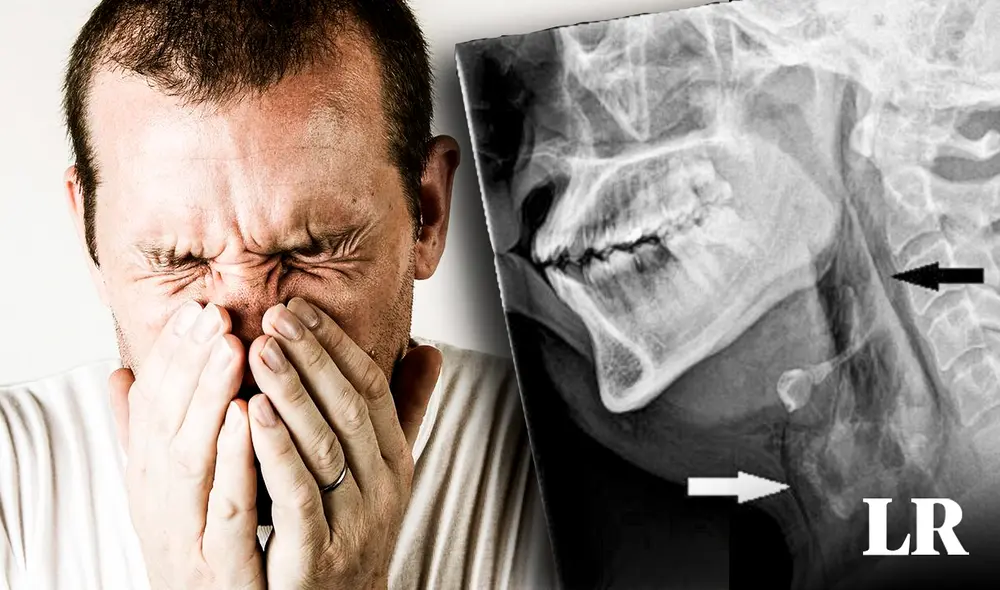 Aguantarse los estornudos puede ser peligrosos para nuestra salud y este estudio lo demuestra por primera vez. Foto: composición de Fabrizio Oviedo / La República Aguantarse los estornudos puede ser peligrosos para nuestra salud y este estudio lo demuestra por primera vez. Foto: composición de Fabrizio Oviedo / La República