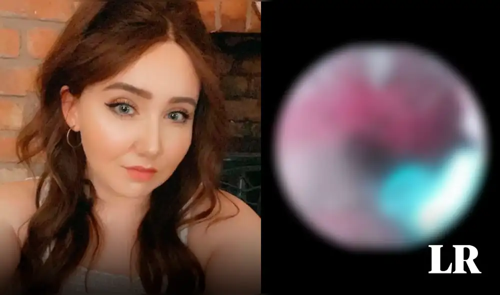 La mujer descubrió los insectos tras un dolor “rasposo” que inspeccionó con detenimiento con una cámara. Foto: composición LR/Daily Mail