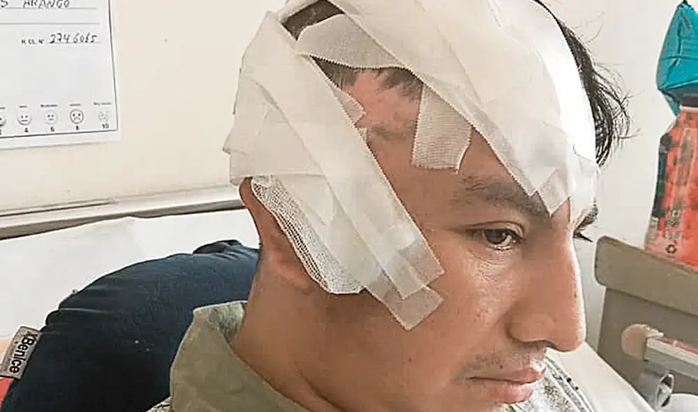 Cirugía. Marcas fue sometido a una craneoplastia. Vive sin poder trabajar para sus dos hijas. Foto: difusión