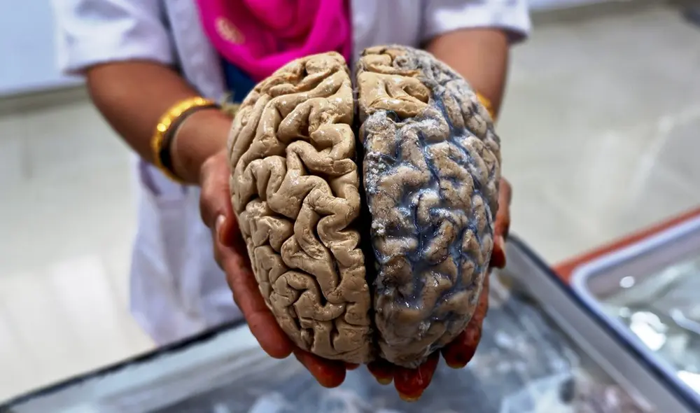 Un tratamiento hormonal para el crecimiento habría sido el responsable del desarrollo temprano del alzheimer. Foto: Atlas Obscura