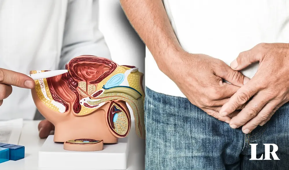 Los médicos peruanos exhortan a la población masculina a realizarse los exámenes urológicos pertinentes para el diagnóstico temprano de esta enfermedad. Foto: composición de Fabrizio Oviedo/LR/Urologiasanrafael. Video: TVPerú
