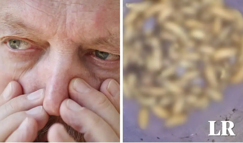 En Florida, Estados Unidos, un hombre tuvo que ser atendido de emergencia tras alojar decenas de bichos en su nariz, los cuales contrajo hace más de 5 meses. Foto: composición LR/Depositphotos/First coast news En Florida, Estados Unidos, un hombre tuvo que ser atendido de emergencia tras alojar decenas de bichos en su nariz, los cuales contrajo hace más de 5 meses. Foto: composición LR/Depositphotos/First coast news